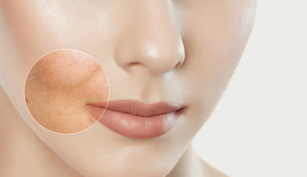 Effective Solutions for Pore Problems